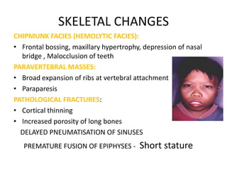 SKELETAL CHANGES
CHIPMUNK FACIES (HEMOLYTIC FACIES):
• Frontal bossing, maxillary hypertrophy, depression of nasal
  bridge , Malocclusion of teeth
PARAVERTEBRAL MASSES:
• Broad expansion of ribs at vertebral attachment
• Paraparesis
PATHOLOGICAL FRACTURES:
• Cortical thinning
• Increased porosity of long bones
  DELAYED PNEUMATISATION OF SINUSES
   PREMATURE FUSION OF EPIPHYSES -      Short stature
 