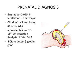 PRENATAL DIAGNOSIS
• β/α ratio: <0.025 in
  fetal blood – Thal major
• Chorionic villous biopsy
  at 10-12 wks
• amniocentesis at 15-
  18th wk gestation
  Analysis of fetal DNA
• PCR to detect β globin
  gene
 