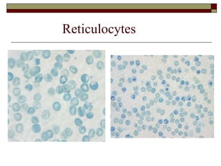 Hematology (1) The blood and bone marrow, abnormal blood count, anemias ...