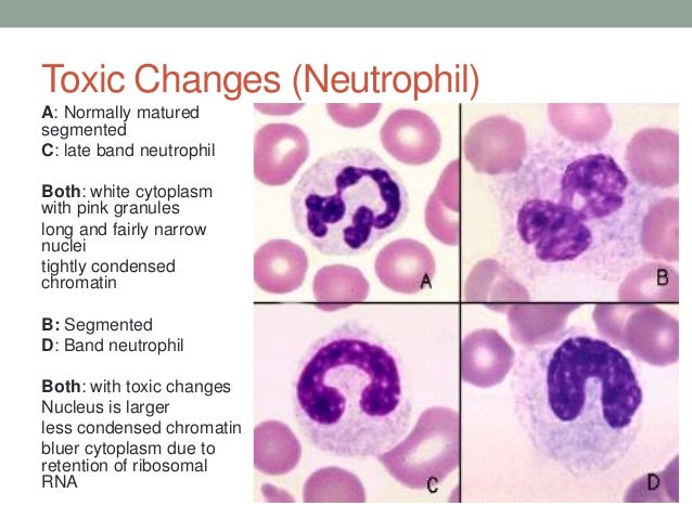 diseases with chromatin negative nuclei diseases with chromatin negative nuclei