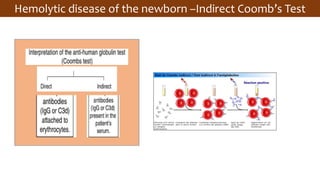 Hemolytic disease of the newborn –Indirect Coomb’s Test
 