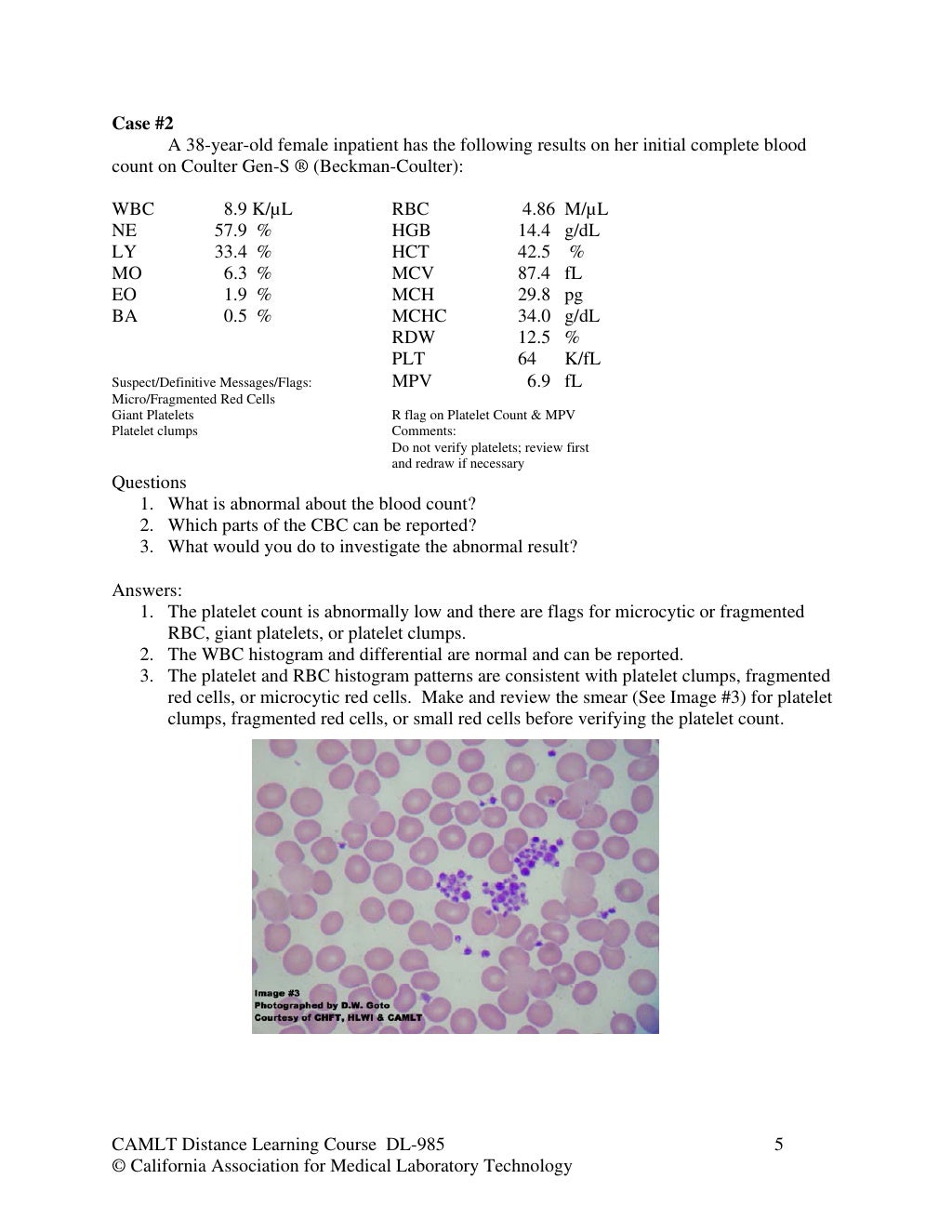 Hematology case studies Platelets