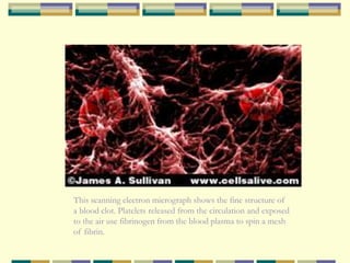 This scanning electron micrograph shows the fine structure of
a blood clot. Platelets released from the circulation and exposed
to the air use fibrinogen from the blood plasma to spin a mesh
of fibrin.
 