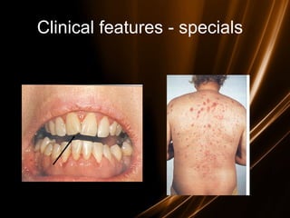 Clinical features - specials
 