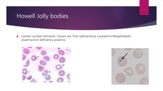 Howell Body Hematology part 1 | PPTX