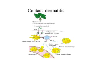 Contact dermatitis
 