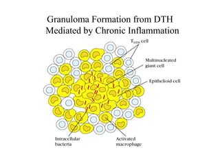 Granuloma Formation from DTH
Mediated by Chronic Inflammation
 