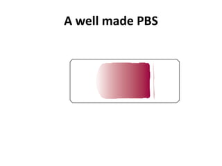 A well made PBS
 