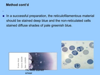 Method cont’d
.
 In a successful preparation, the reticulofilamentous material
should be stained deep blue and the non-reticulated cells
stained diffuse shades of pale greenish blue.
1% NMB stained
smear
 