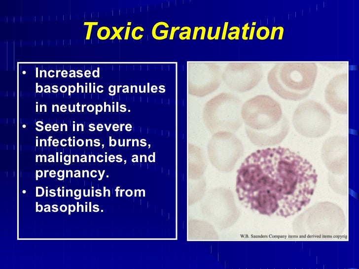 Hematology review '04