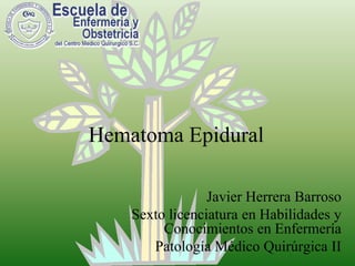 Hematoma Epidural Javier Herrera Barroso Sexto licenciatura en Habilidades y Conocimientos en Enfermería Patología Médico Quirúrgica II 