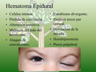 Hematoma Epidural<br />Cefalea intensa.<br />Pérdida de conciencia.<br />Alteración sensitiva.<br />Midriasis del lado del...
