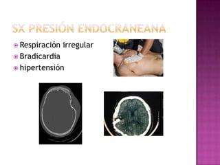  Respiración   irregular
 Bradicardia
 hipertensión
 