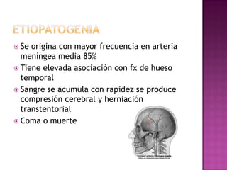 Se origina con mayor frecuencia en arteria
  meníngea media 85%
 Tiene elevada asociación con fx de hueso
  temporal
 ...