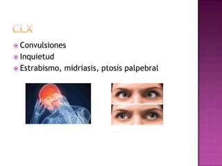  Convulsiones
 Inquietud
 Estrabismo,   midriasis, ptosis palpebral
 