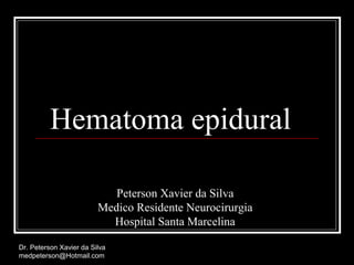 Hematoma epidural
Peterson Xavier da Silva
Medico Residente Neurocirurgia
Hospital Santa Marcelina
Dr. Peterson Xavier da Silva
medpeterson@Hotmail.com
 