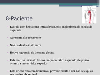 8-Paciente
• Evoluiu com hematoma intra aórtico, pós-angioplastia de subclávia
esquerda
• Apresenta dor recorrente
• Não há dilatação de aorta
• Houve regressão do derrame pleural
• Extensão do inicio do tronco braquiocefálico esquerdo até pouco
acima da mesentérica superior
• Esta artéria esta com bom fluxo, provavelmente a dor não se explica

 