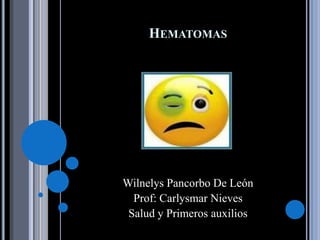 HEMATOMAS




Wilnelys Pancorbo De León
  Prof: Carlysmar Nieves
 Salud y Primeros auxilios
 