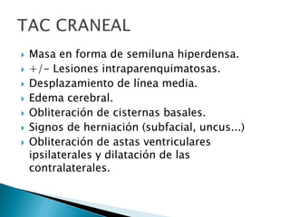    Masa en forma de semiluna hiperdensa.
   +/- Lesiones intraparenquimatosas.
   Desplazamiento de línea media.
   Edema cerebral.
   Obliteración de cisternas basales.
   Signos de herniación (subfacial, uncus...)
   Obliteración de astas ventriculares
    ipsilaterales y dilatación de las
    contralaterales.
 