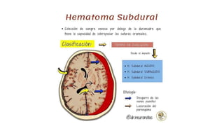 hematoma subdural agudo y cronico (1).pptx