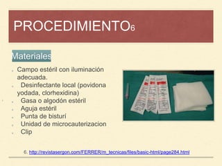 PROCEDIMIENTO6
¡
6. http://revistasergon.com/FERRER/m_tecnicas/files/basic-html/page284.html
Campo estéril con iluminación
adecuada.
Desinfectante local (povidona
yodada, clorhexidina)
Gasa o algodón estéril
Aguja estéril
Punta de bisturí
Unidad de microcauterizacion
Clip
Materiales
 