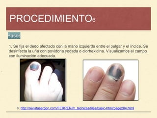 PROCEDIMIENTO6
¡
6. http://revistasergon.com/FERRER/m_tecnicas/files/basic-html/page284.html
Pasos
1. Se fija el dedo afectado con la mano izquierda entre el pulgar y el índice. Se
desinfecta la uña con povidona yodada o clorhexidina. Visualizamos el campo
con iluminación adecuada.
 