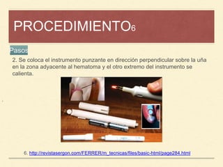PROCEDIMIENTO6
¡
6. http://revistasergon.com/FERRER/m_tecnicas/files/basic-html/page284.html
Pasos
2. Se coloca el instrumento punzante en dirección perpendicular sobre la uña
en la zona adyacente al hematoma y el otro extremo del instrumento se
calienta.
 