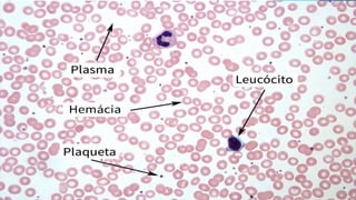 Hematopoiese aula 3.pptx