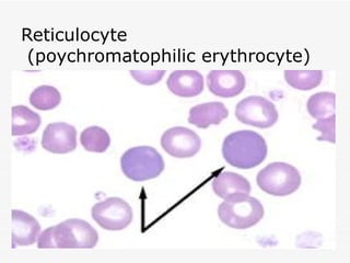 Reticulocyte
 (poychromatophilic erythrocyte)
 