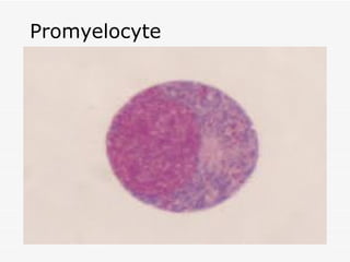 Promyelocyte
 