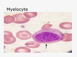 Myelocyte
 