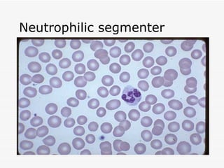 Neutrophilic segmenter
 