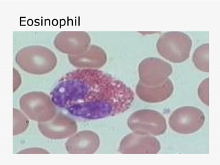 Eosinophil
 