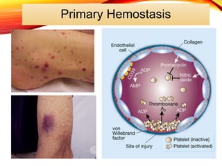 Primary Hemostasis
 