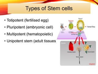 Types of Stem cells
• Totipotent (fertilised egg)
• Pluripotent (embryonic cell)
• Multipotent (hematopoietic)
• Unipotent stem (adult tissues)
 