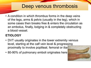 Deep venous thrombosis
• A condition in which thrombus forms in the deep veins
of the legs, arms & pelvis (usually in the leg), which in
some cases then breaks free & enters the circulation as
an embolus, finally, lodging in & completely obstructing
a blood vessel.
ETIOLOGY
• DVT usually originates in the lower extremity venous
level, starting at the calf vein level & progressing
proximally to involve popliteal, femoral or iliac system.
• 80-90% of pulmonary emboli originates here
 