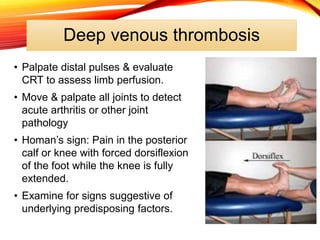 Deep venous thrombosis
• Palpate distal pulses & evaluate
CRT to assess limb perfusion.
• Move & palpate all joints to detect
acute arthritis or other joint
pathology
• Homan’s sign: Pain in the posterior
calf or knee with forced dorsiflexion
of the foot while the knee is fully
extended.
• Examine for signs suggestive of
underlying predisposing factors.
 