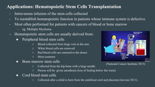 Hematopoietic Stem Cells Transplantation for Multiple Myeloma | PDF