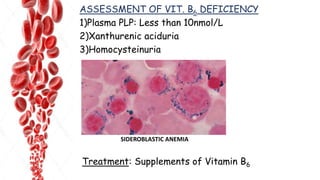 ASSESSMENT OF VIT. B6 DEFICIENCY
1)Plasma PLP: Less than 10nmol/L
2)Xanthurenic aciduria
3)Homocysteinuria
SIDEROBLASTIC ANEMIA
Treatment: Supplements of Vitamin B6
 