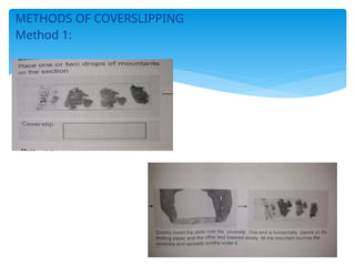 METHODS OF COVERSLIPPING
Method 1:
 