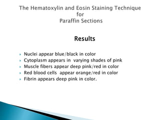 Results
 Nuclei appear blue/black in color
 Cytoplasm appears in varying shades of pink
 Muscle fibers appear deep pink/red in color
 Red blood cells appear orange/red in color
 Fibrin appears deep pink in color.
 