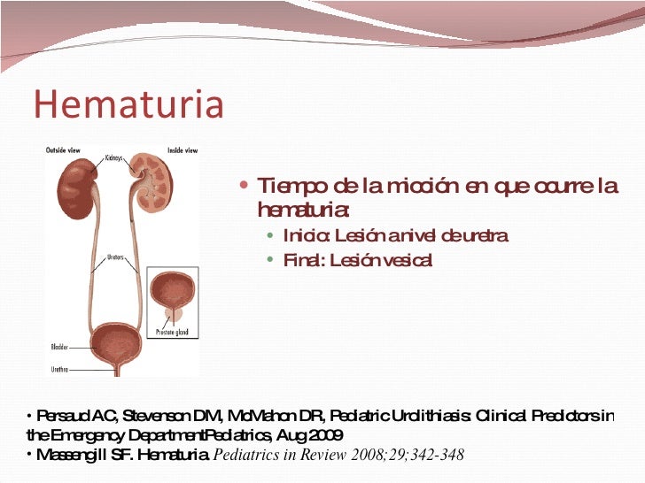 CPHAP 034 Hematuria