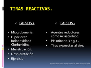 TIRAS REACTIVAS.

    o FALSOS +                  o FALSOS -

• Mioglobunuria.    •    Agentes reductores
• Hipoclorito            como Ac ascórbico.
  Iodopovidona      •    PH urinario < a 5.1 .
  Clorhexidina.     •    Tiras expuestas al aire.
• Menstruación.
• Deshidratación.
• Ejercicio.
                        RICHARD J BRYANT, JAMES WF CATTO. HAEMATURIA. RENAL AND UROLOGY. 2008.
 