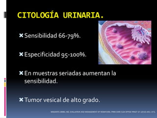 CITOLOGÍA URINARIA.

 Sensibilidad 66-79%.


 Especificidad 95-100%.


 En muestras seriadas aumentan la
  sensibilidad.

 Tumor vesical de alto grado.
            MASAHITO JIMBO, MD. EVALUATION AND MANAGEMENT OF HEMATURIA. PRIM CARE CLIN OFFICE PRACT 37 (2010) 461–472.
 