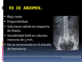 RX DE ABDOMEN.
  Bajo costo.
  Disponibilidad.
  Solo tiene cabida en sospecha
   de litiasis.
  Sensibilidad 60% en cálculos
   menores de 5 mm.
  No se recomienda en el estudio
   de hematuria
KEVIN N. O’REGAN, OWEN J. O’CONNOR, MD, PATRICK MCLOUGHLIN. THE ROLE OF IMAGING IN THE INVESTIGATION OF PAINLESS HEMATURIA IN ADULTS. SEMIN
                                                                                                        ULTRASOUND CT MRI 30:258-270. 2009.
 