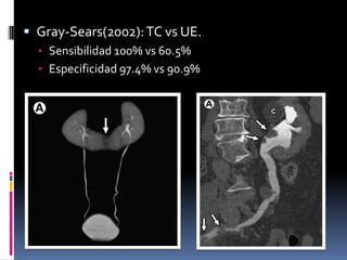  Gray-Sears(2002): TC vs UE.
  • Sensibilidad 100% vs 60.5%
  • Especificidad 97.4% vs 90.9%
 