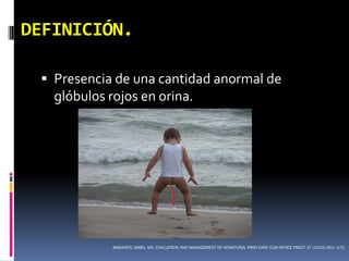 DEFINICIÓN.

  Presencia de una cantidad anormal de
   glóbulos rojos en orina.




            MASAHITO JIMBO, MD. EVALUATION AND MANAGEMENT OF HEMATURIA. PRIM CARE CLIN OFFICE PRACT 37 (2010) 461–472.
 