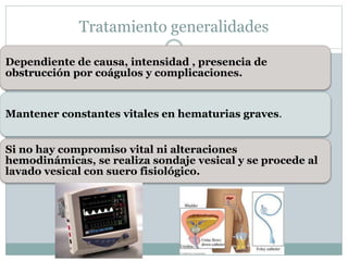 Dependiente de causa, intensidad , presencia de
obstrucción por coágulos y complicaciones.
Mantener constantes vitales en hematurias graves.
Si no hay compromiso vital ni alteraciones
hemodinámicas, se realiza sondaje vesical y se procede al
lavado vesical con suero fisiológico.
Tratamiento generalidades
 