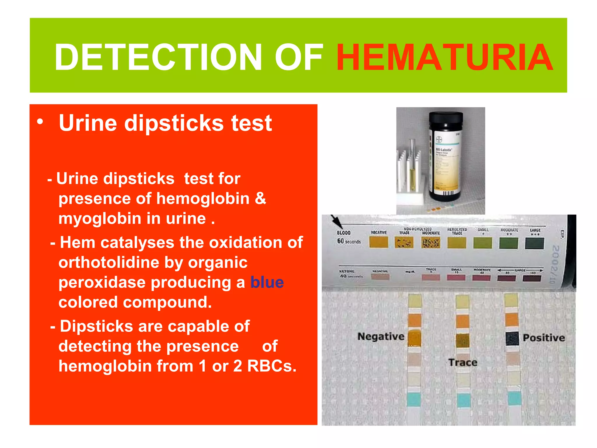 Hematuria | PPT