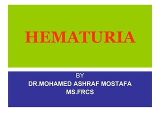HEMATURIA
BY
DR.MOHAMED ASHRAF MOSTAFA
MS.FRCS
 
